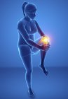 Женский силуэт с болью в колене, цифровая иллюстрация . — стоковое фото