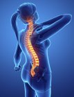 Silhueta feminina com dor nas costas, ilustração digital. — Fotografia de Stock
