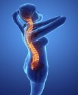 Silueta femenina con dolor de espalda, ilustración digital. - foto de stock