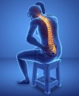 Silueta femenina con dolor de espalda, ilustración digital. - foto de stock