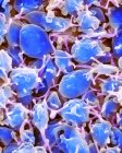 Fragments de cellules sanguines activées plaquettes, micrographie électronique à balayage coloré . — Photo de stock