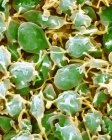 Fragmentos de células sanguíneas ativados plaquetas, micrografia eletrônica de varredura colorida . — Fotografia de Stock