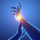 Male hands silhouette with wrist pain, digital illustration. — Stock Photo