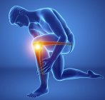 Curvatura sagoma maschile con dolore al ginocchio, illustrazione digitale . — Foto stock