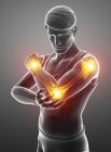 Мужской силуэт с болью в руке, цифровая иллюстрация . — стоковое фото