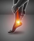 Силуэт мужской ноги с болью в ноге, цифровая иллюстрация . — стоковое фото