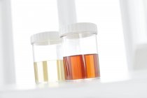 Sang dans l'urine humaine dans des pots d'échantillons, plan studio . — Photo de stock