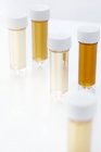 Tubes à essai avec échantillons d'urine pour analyse, plan studio . — Photo de stock