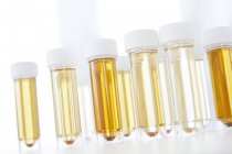Scaffale provette con campioni di urina per analisi, ripresa in studio . — Foto stock