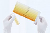 Scientist hands holding urine sample in container and chart, studio shot. — Stock Photo