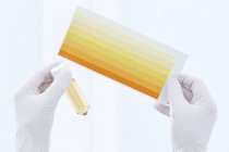 Mãos do cientista segurando amostra de urina em recipiente e gráfico, tiro estúdio . — Fotografia de Stock