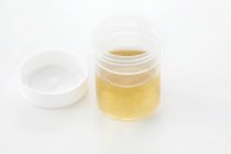 Urine sample in container for analysis, studio shot. — Stock Photo