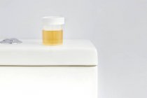Recipiente de muestra de orina en el inodoro en el baño, toma de estudio . - foto de stock