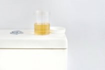 Contenitore del campione di urina sulla toilette in bagno, ripresa in studio
. — Foto stock