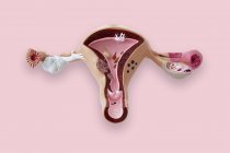 Modelo del sistema reproductor femenino . - foto de stock