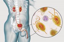 Illustration of male urinary system and parasitic Trichomonas vaginalis causing trichomoniasis. — Stock Photo