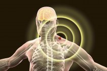 Human silhouette with tick-borne encephalitis brain inflammation, digital illustration. — Stock Photo