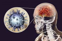 Illustrazione digitale concettuale dell'encefalite causata dal virus della varicella zoster . — Foto stock