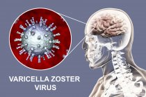 Conceptual digital illustration of encephalitis caused by varicella zoster virus. — Stock Photo