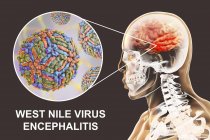 Illustration numérique conceptuelle de l'encéphalite causée par le virus du Nil occidental . — Photo de stock