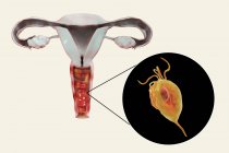 Digitale Illustration des weiblichen Fortpflanzungssystems und des parasitären Mikroorganismus Trichomonas vaginalis, der Trichomoniasis verursacht. — Stockfoto
