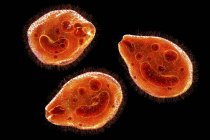 Ilustración digital de protozoos ciliados Parásitos intestinales de Balantidium coli que causan úlcera en el tracto intestinal . - foto de stock