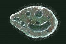 Ilustración digital del protozoo ciliado Balantidium coli parásito intestinal que causa úlcera en el tracto intestinal . - foto de stock