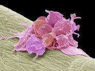 Coloured scanning electron micrograph of activated platelets attached to surgical gauze. — Stock Photo