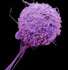Coloured scanning electron micrograph of macrophage white blood cell. — Stock Photo