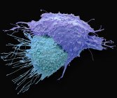 Micrographie électronique à balayage coloré des cellules cancéreuses ovariennes
. — Photo de stock