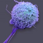 Micrógrafo electrónico de barrido coloreado de glóbulos blancos macrófagos . - foto de stock