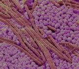Micrografia eletrônica de varredura colorida de bactérias na superfície da língua humana . — Fotografia de Stock