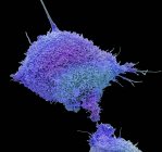 Micrografo elettronico a scansione colorata di cellule tumorali coltivate dalla cervice umana che mostra numerosi microvilli . — Foto stock