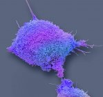 Farbige Rasterelektronenmikroskopie kultivierter Krebszellen aus menschlichem Gebärmutterhals, die zahlreiche Mikrovilli zeigt. — Stockfoto