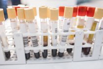 Labeled medical samples in rack, close-up. — Stock Photo