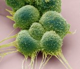 Prostate cancer cells, coloured scanning electron micrograph. — Stock Photo