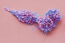 Cellules cancéreuses ovariennes, micrographie électronique à balayage coloré . — Photo de stock