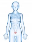 Ilustración médica del cáncer de vejiga en la silueta femenina . - foto de stock