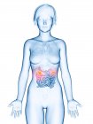 Медицинская иллюстрация рака тонкой кишки в женском силуэте
. — стоковое фото