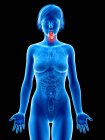 Medizinische Illustration von Kehlkopfkrebs in weiblicher Silhouette. — Stockfoto