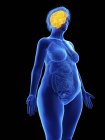 Ilustración de la silueta azul de la mujer obesa con el cerebro resaltado sobre fondo negro . - foto de stock