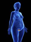 Illustration of blue silhouette of obese woman with highlighted bladder on black background. — Stock Photo