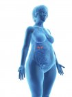 Illustrazione della silhouette blu della donna obesa con ghiandole surrenali evidenziate su sfondo bianco
. — Foto stock