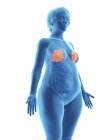 Ілюстрація синього силуету ожиріння жінки з підсвіченими молочними залозами на білому тлі . — стокове фото