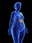 Illustration of blue silhouette of obese woman with highlighted spleen on black background. — Stock Photo