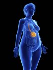 Illustrazione della silhouette blu della donna obesa con lo stomaco evidenziato su sfondo nero . — Foto stock