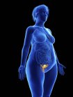 Illustration der blauen Silhouette einer fettleibigen Frau mit hervorgehobenem Uterus auf schwarzem Hintergrund. — Stockfoto