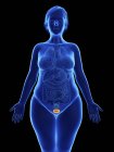 Ilustración frontal de la silueta azul de la mujer obesa con la vejiga resaltada sobre fondo negro . - foto de stock