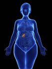 Frontal illustration of blue silhouette of obese woman with highlighted gallbladder on black background. — Stock Photo