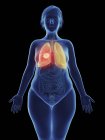 Ilustración de tumor canceroso en pulmón femenino . - foto de stock